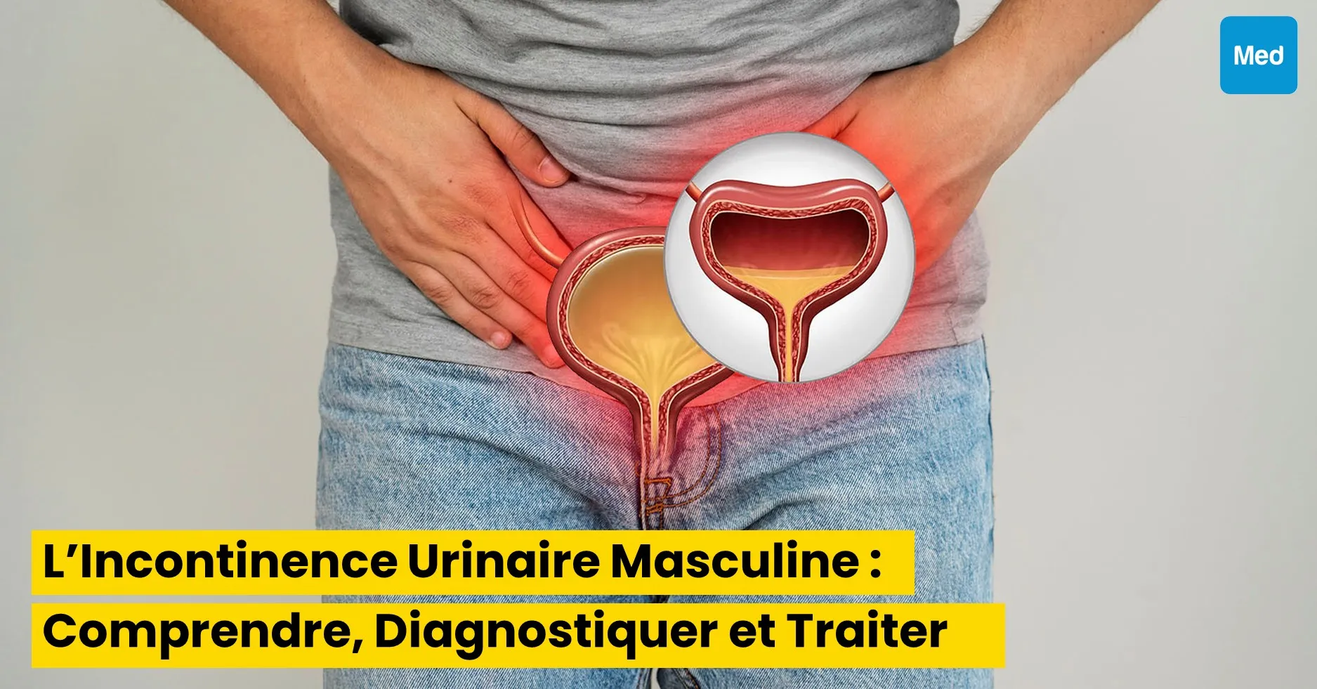 L’Incontinence Urinaire Masculine : Comprendre, Diagnostiquer et Traiter